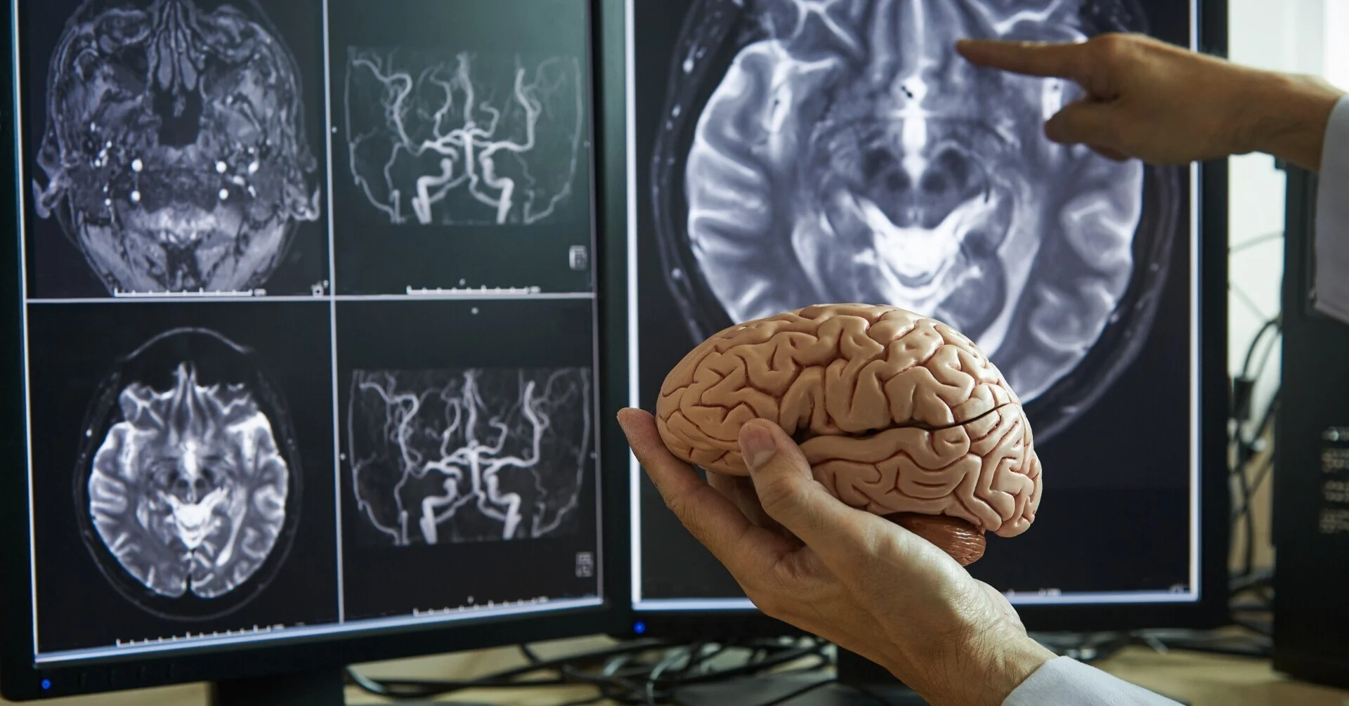脳模型とMRI画像